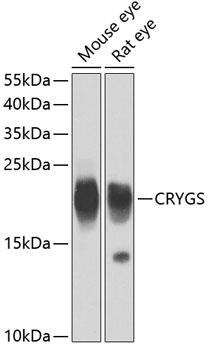 Western blot analysis of extracts of various cell lines using CRYGS Polyclonal Antibody at dilution of 1:4000.