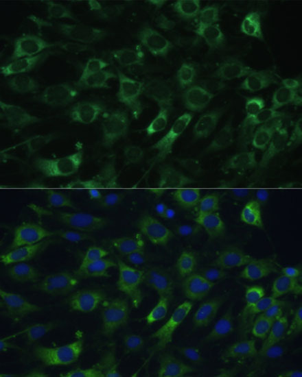 Immunofluorescence analysis of C6 cells using EEF1G Polyclonal Antibody at dilution of  1:100 (40x lens). Blue: DAPI for nuclear staining.