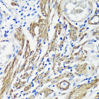 Immunohistochemistry of paraffin-embedded Human colon muscle using FLNA Polyclonal Antibody at dilution of  1:100 (40x lens).