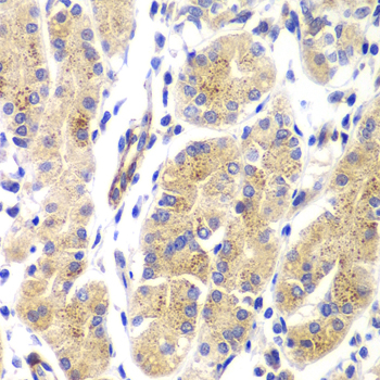 Immunohistochemistry of paraffin-embedded Human gastric using HRas Polyclonal Antibody at dilution of  1:100 (40x lens).