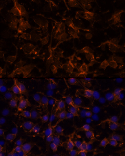Immunofluorescence analysis of C6 cells using NCAM1 / CD56 Polyclonal Antibody at dilution of  1:100. Blue: DAPI for nuclear staining.