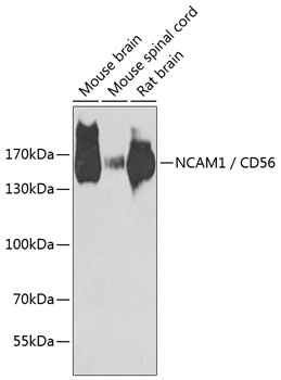 Western blot analysis of extracts of various cell lines using NCAM1 / CD56 Polyclonal Antibody at dilution of 1:1000.