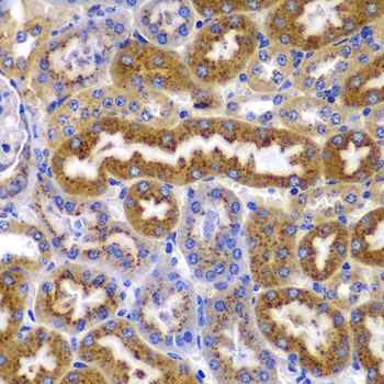 Immunohistochemistry of paraffin-embedded Mouse kidney using PRKAB1 Polyclonal Antibody at dilution of  1:100 (40x lens).