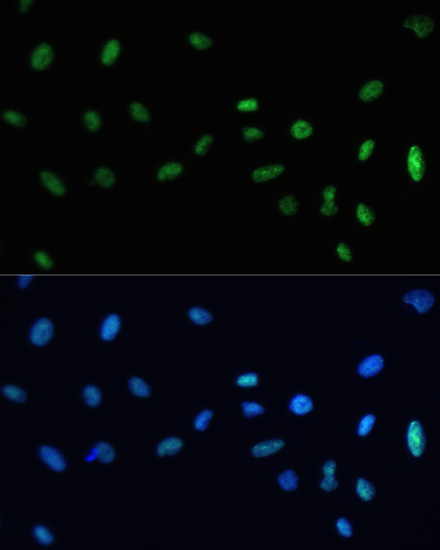 Immunofluorescence analysis of U-2 OS cells using SAFB Polyclonal Antibody at dilution of  1:100. Blue: DAPI for nuclear staining.