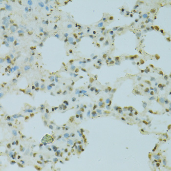 Immunohistochemistry of paraffin-embedded Rat lung using SAFB Polyclonal Antibody at dilution of  1:100 (40x lens).