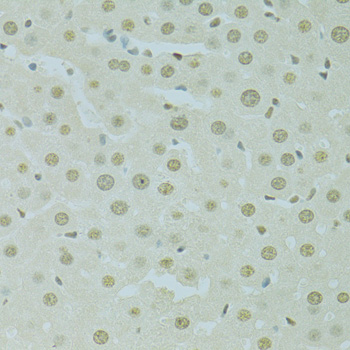 Immunohistochemistry of paraffin-embedded Rat liver using SAFB Polyclonal Antibody at dilution of  1:100 (40x lens).