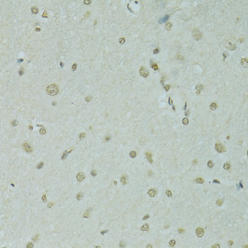 Immunohistochemistry of paraffin-embedded Rat brain using SAFB Polyclonal Antibody at dilution of  1:100 (40x lens).