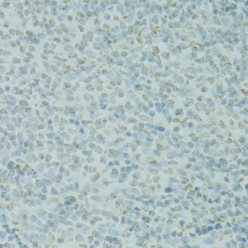 Immunohistochemistry of paraffin-embedded Rat spleen using SAFB Polyclonal Antibody at dilution of  1:100 (40x lens).