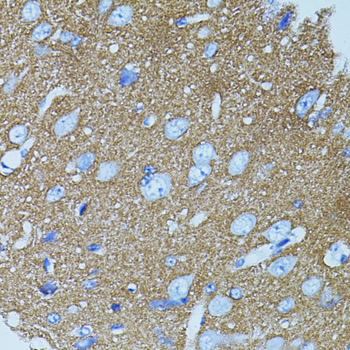 Immunohistochemistry of paraffin-embedded Rat brain using STX1A Polyclonal Antibody