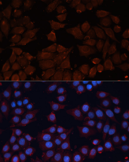 Immunofluorescence analysis of HeLa cells using ADAM12 Polyclonal Antibody at dilution of  1:100. Blue: DAPI for nuclear staining.