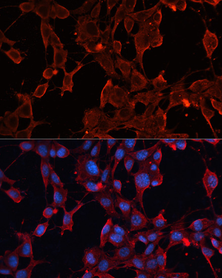 Immunofluorescence analysis of NIH/3T3 cells using ADAM12 Polyclonal Antibody at dilution of  1:100. Blue: DAPI for nuclear staining.