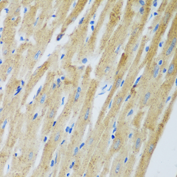 Immunohistochemistry of paraffin-embedded Rat heart using ADAM12 Polyclonal Antibody at dilution of  1:100 (40x lens).