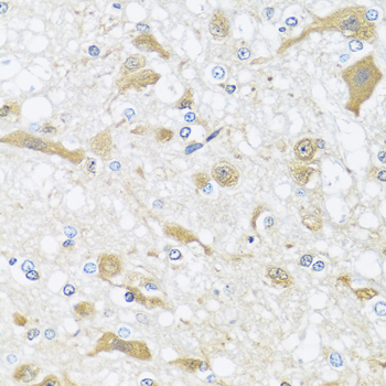 Immunohistochemistry of paraffin-embedded Rat brain using APOL1 Polyclonal Antibody at dilution of  1:100 (40x lens).