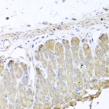 Immunohistochemistry of paraffin-embedded Mouse stomach using IRS2 Polyclonal Antibody at dilution of  1:100 (40x lens).