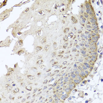 Immunohistochemistry of paraffin-embedded Human esophagus using IRS2 Polyclonal Antibody at dilution of  1:100 (40x lens).