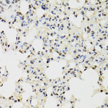 Immunohistochemistry of paraffin-embedded Mouse lung using KDM4A Polyclonal Antibody at dilution of  1:100 (40x lens).