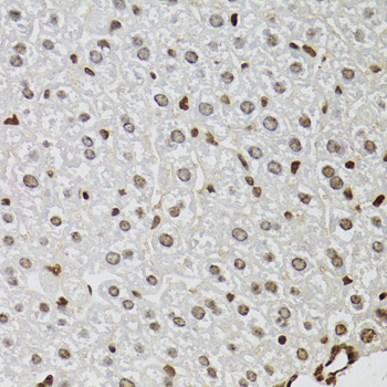 Immunohistochemistry of paraffin-embedded Mouse liver using KDM4A Polyclonal Antibody at dilution of  1:100 (40x lens).