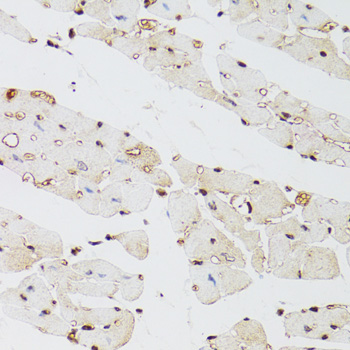 Immunohistochemistry of paraffin-embedded Mouse heart using KDM4A Polyclonal Antibody at dilution of  1:100 (40x lens).