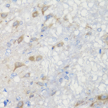 Immunohistochemistry of paraffin-embedded Rat brain using CHIC2 Polyclonal Antibody at dilution of  1:100 (40x lens).