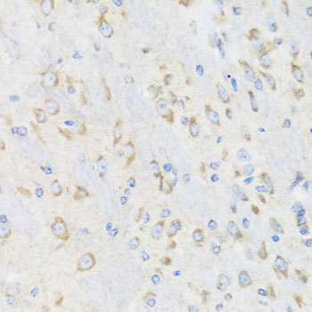 Immunohistochemistry of paraffin-embedded Mouse brain using CHIC2 Polyclonal Antibody at dilution of  1:100 (40x lens).