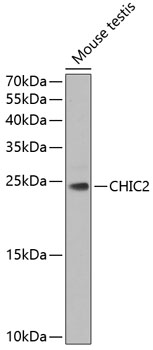 Western blot analysis of extracts of Mouse testis using CHIC2 Polyclonal Antibody at dilution of 1:1000.