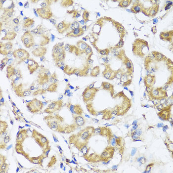 Immunohistochemistry of paraffin-embedded Human stomach using B9D1 Polyclonal Antibody at dilution of  1:100 (40x lens).