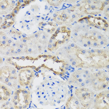 Immunohistochemistry of paraffin-embedded Rat kidney using B9D1 Polyclonal Antibody at dilution of  1:100 (40x lens).