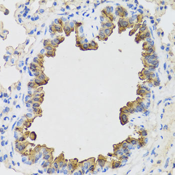 Immunohistochemistry of paraffin-embedded Mouse lung using B9D1 Polyclonal Antibody at dilution of  1:100 (40x lens).