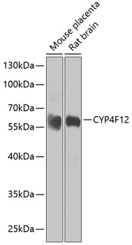 Western blot analysis of extracts of various cell lines using CYP4F12 Polyclonal Antibody at dilution of 1:1000.