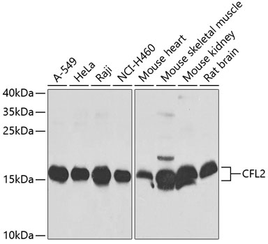 Western blot analysis of extracts of various cell lines using CFL2 Polyclonal Antibody at dilution of 1:1000.