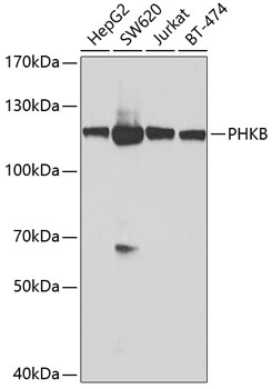 Western blot analysis of extracts of various cell lines using PHKB Polyclonal Antibody at dilution of 1:1000.
