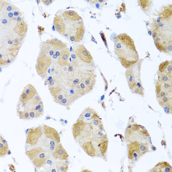 Immunohistochemistry of paraffin-embedded Human stomach using MYLK Polyclonal Antibody at dilution of  1:100 (40x lens).