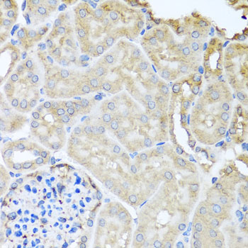 Immunohistochemistry of paraffin-embedded Mouse kidney using MYLK Polyclonal Antibody at dilution of  1:100 (40x lens).