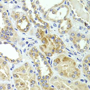 Immunohistochemistry of paraffin-embedded Human kidney using HMGCL Polyclonal Antibody at dilution of  1:100 (40x lens).