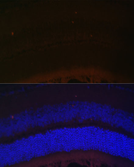 Immunofluorescence analysis of Mouse retina using RDH5 Polyclonal Antibody at dilution of  1:100 (40x lens). Blue: DAPI for nuclear staining.