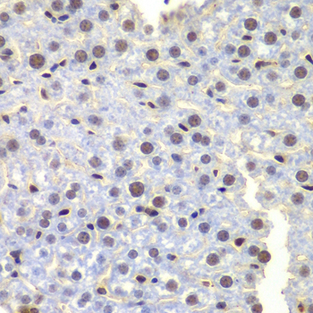 Immunohistochemistry of paraffin-embedded Mouse liver using LHX4 Polyclonal Antibody at dilution of  1:100 (40x lens).