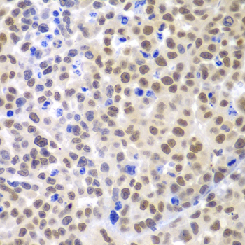 Immunohistochemistry of paraffin-embedded Mouse cancer using LHX4 Polyclonal Antibody at dilution of  1:100 (40x lens).