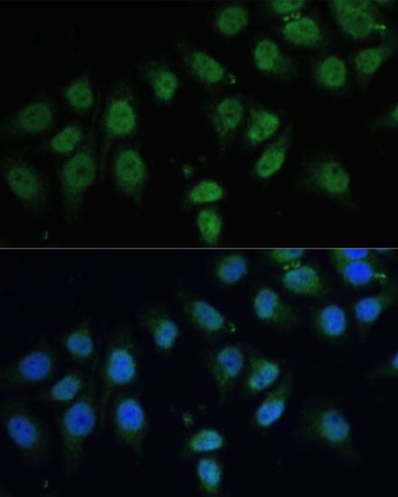Immunofluorescence analysis of HeLa cells using CPS1 Polyclonal Antibody at dilution of  1:100 (40x lens). Blue: DAPI for nuclear staining.