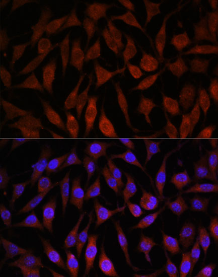 Immunofluorescence analysis of L929 cells using NEDD4L Polyclonal Antibody at dilution of  1:100. Blue: DAPI for nuclear staining.