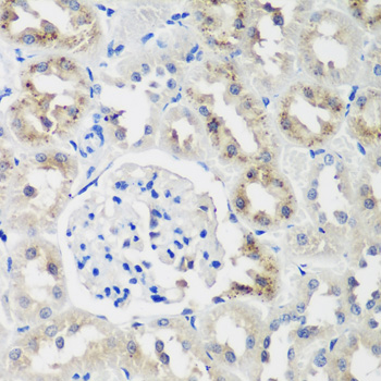 Immunohistochemistry of paraffin-embedded Rat kidney using NEDD4L Polyclonal Antibody at dilution of  1:200 (40x lens).