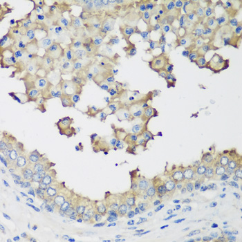 Immunohistochemistry of paraffin-embedded Human prostate using NEDD4L Polyclonal Antibody at dilution of  1:200 (40x lens).