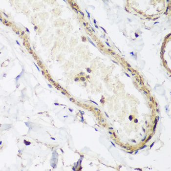 Immunohistochemistry of paraffin-embedded Human colon using CAV3 Polyclonal Antibody at dilution of  1:200 (40x lens).