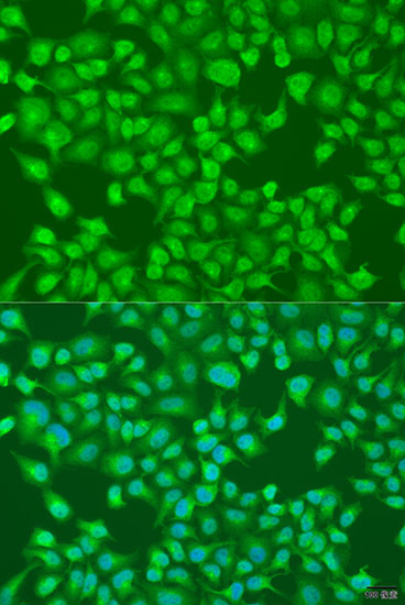 Immunofluorescence analysis of U2OS cells using ACOX1 Polyclonal Antibody at dilution of  1:100. Blue: DAPI for nuclear staining.