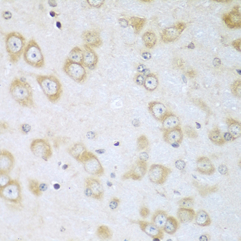 Immunohistochemistry of paraffin-embedded Mouse brain using ACOX1 Polyclonal Antibody at dilution of  1:100 (40x lens).