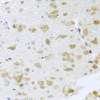 Immunohistochemistry of paraffin-embedded Mouse brain using Gm13125 Polyclonal Antibody at dilution of  1:100 (40x lens).