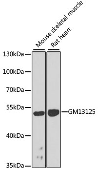 Western blot analysis of extracts of various cell lines using Gm13125 Polyclonal Antibody at dilution of 1:1000.