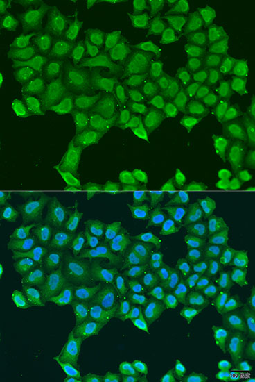 Immunofluorescence analysis of U2OS cells using ATP5O Polyclonal Antibody at dilution of  1:100. Blue: DAPI for nuclear staining.