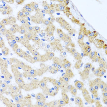 Immunohistochemistry of paraffin-embedded Human liver damage using CETN3 Polyclonal Antibody at dilution of  1:100 (40x lens).