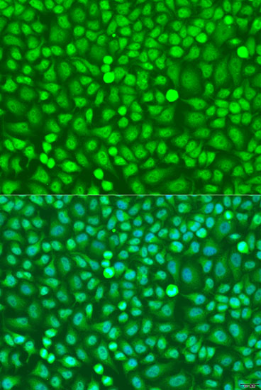 Immunofluorescence analysis of U2OS cells using HOXB5 Polyclonal Antibody at dilution of  1:100. Blue: DAPI for nuclear staining.