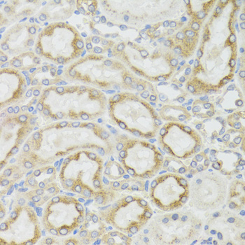 Immunohistochemistry of paraffin-embedded Rat kidney using MT-ND5 Polyclonal Antibody at dilution of  1:100 (40x lens).